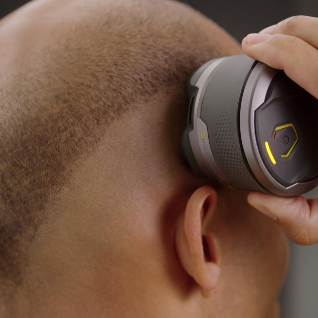 02_Microtouch_Titanium_HeadShaver_5_schwebende_Ko_pfe.jpg
