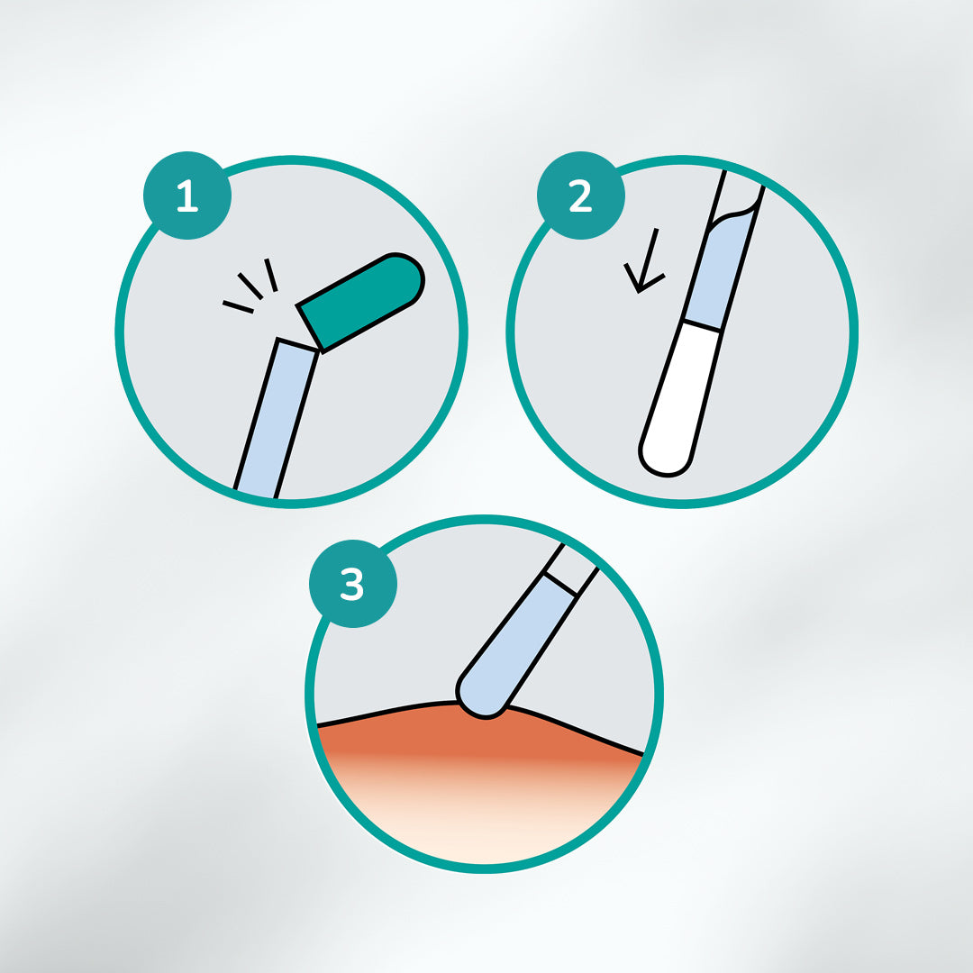 Anleitung zur Anwendung von CLICswab in drei Schritten: 1. Oberes Ende abknicken, 2. Das Serum fließt nach unten in die Spitze, 3. Gezielt auf die betroffene Hautstelle auftragen.