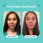 05_Proactiv_Gentle_Bundle_PimplePatches_RealPeople_RealResults2.jpg