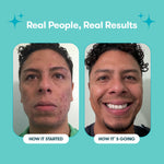06_Proactiv_Gentle_Bundle_PimplePatches_RealPeople_RealResults2.jpg