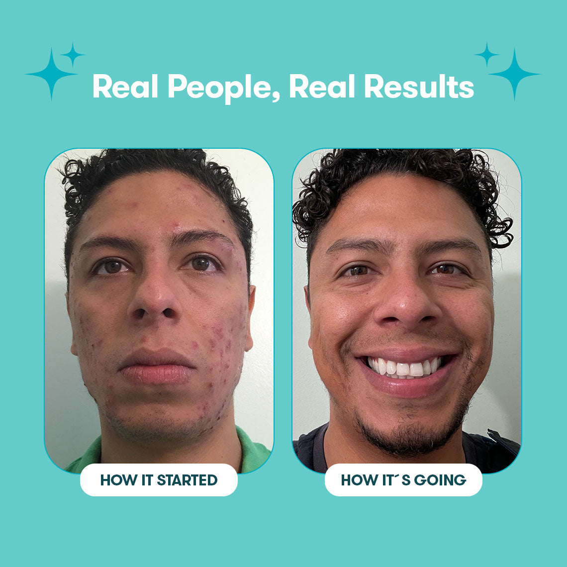 06_Proactiv_Gentle_Bundle_PimplePatches_RealPeople_RealResults2.jpg