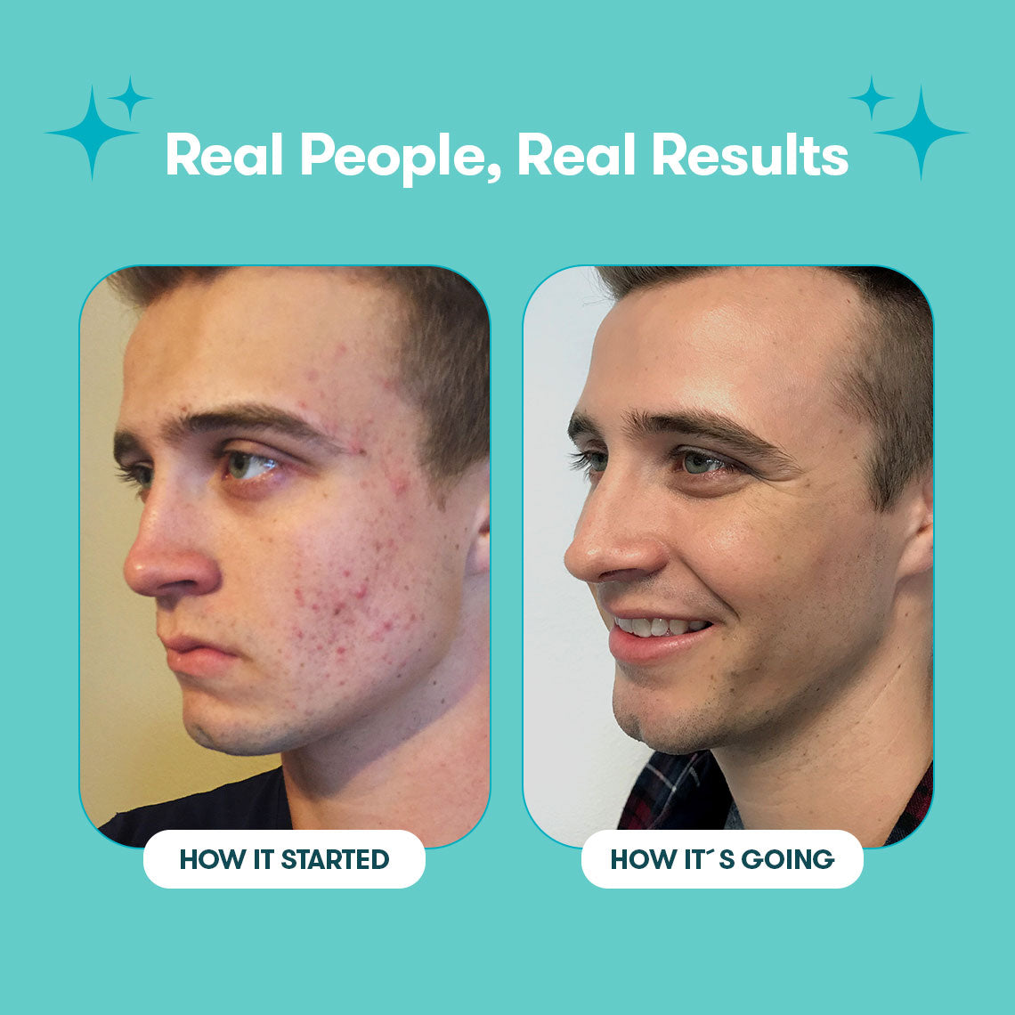 06_Proactiv_Solution_PimplePatches_Testimonials2.jpg