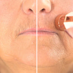 Vorher-nachher-Vergleich der Oberlippe zeigt effektive Haarentfernung mit dem Roxy Pocket Shaver.