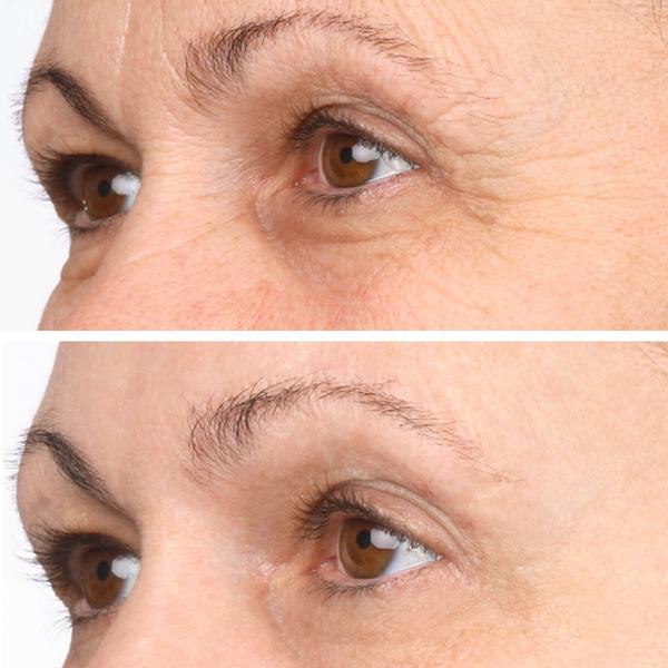 Vitame Collagen Plus by Joachim Kaeser 90 Kapseln 1+1 GRATIS