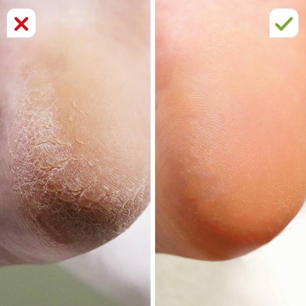 Footlogix Fußpflegekombination für zu Hause 